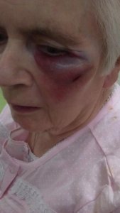 maureen eye 001.jpg