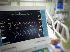 EKG-monitor-000098316407_Medium.jpg
