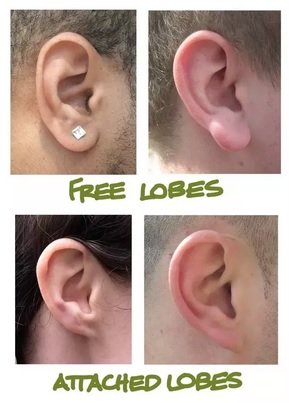 lobes.jpg
