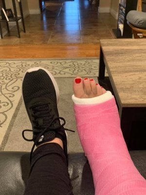 Linda ankle 2.jpg