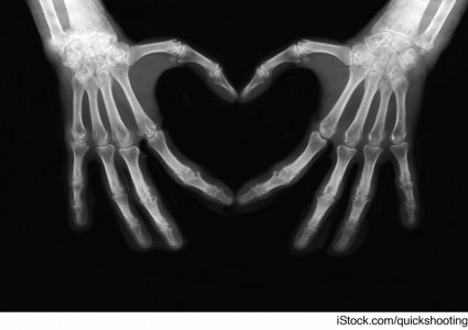 x-rayblog.jpg x-rayblog.jpg