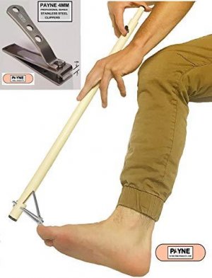 toe nail.jpg
