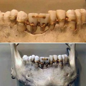 teeth.jpg