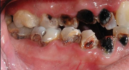 teeth.jpg