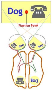 Split brain.1.jpg