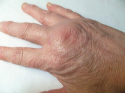 hand.jpg