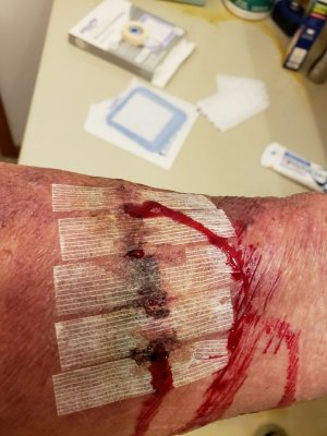 8-8-18 Arm.jpg