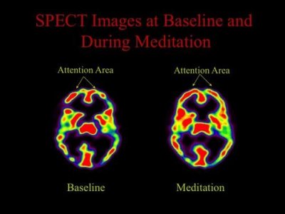 fmri-scans-of-people-meditating.jpg