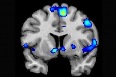 the-nucleus-accumbens.jpg