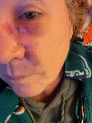 Karen's Face Surgery.jpg