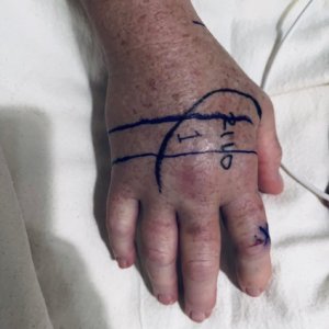 hand.jpg