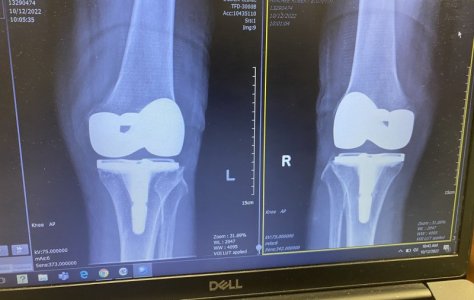 knee1.jpg