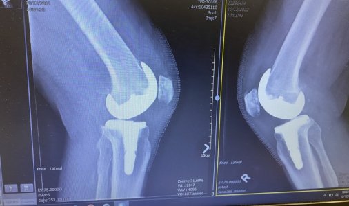 Knee2.jpg
