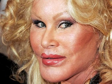 Jocelyn-Wildenstein-5176301_1.jpg