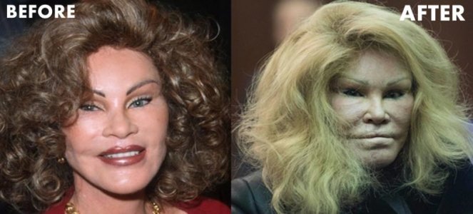 Plastic-Surgery.jpg