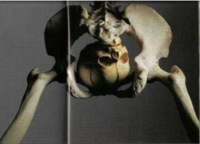 Ancient Politician Remains.jpg