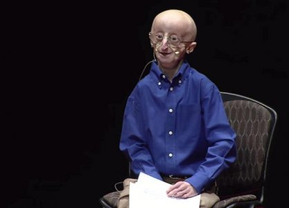 progeria sam.jpg