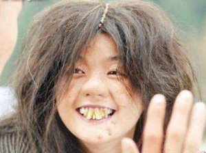 Ugly-and-Weird-People-Ugly-Teeth-03-570x425.jpg