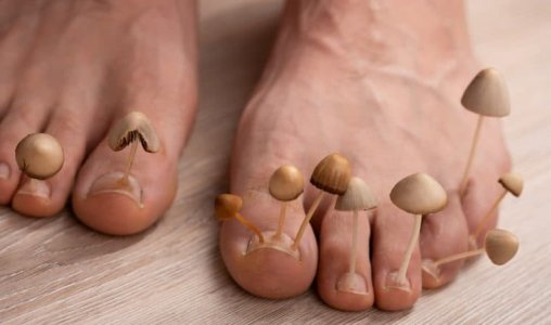 foot-fungus-treatment-feet-first-clinic-geo-768x511 (1).jpg