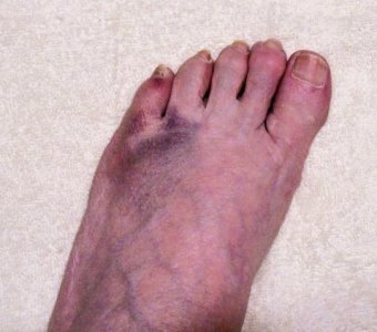 toe3.jpg