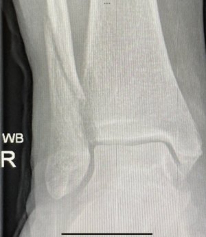 IMG_7182.jpeg IMG_7182.jpeg