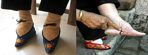 FootBinding -TVOKM.jpg
