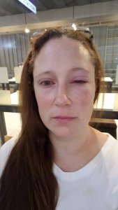 Wendys eye (450x800).jpg Wendys eye (450x800).jpg