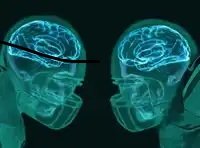 xray-brain.jpg