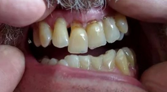 before.jpg before.jpg