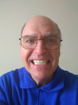 upper_denture.jpg upper_denture.jpg