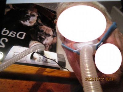 2025-11-22  CPAP.jpg