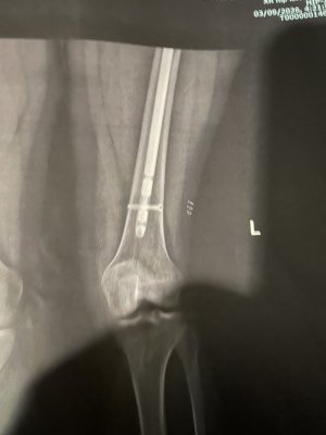 IMG_3613.jpeg IMG_3613.jpeg