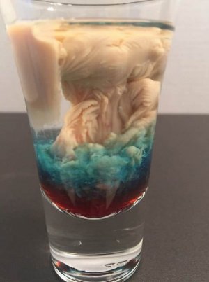 A Alien Brain Hemorrhage.jpg A Alien Brain Hemorrhage.jpg