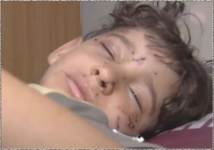Boy attacked.jpg Boy attacked.jpg