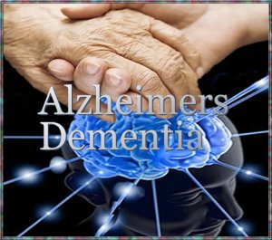 alzheimers.6.jpg alzheimers.6.jpg