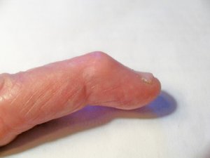 finger.jpg finger.jpg