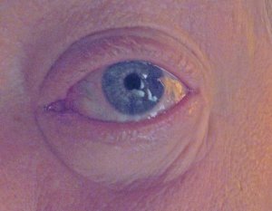 eye.jpg