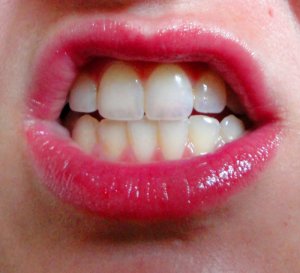 mouth.jpg