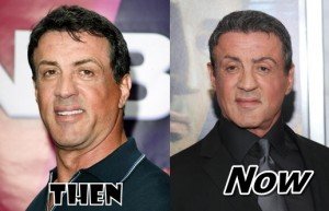 Sylvester-Stallone-Plastic-Surgery-Before-and-After-Pictures-Expendables1-300x193.jpg