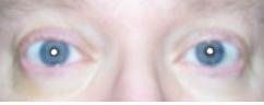 eyes_after.jpg