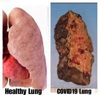 lungs.jpg