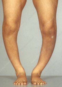 legs.jpg