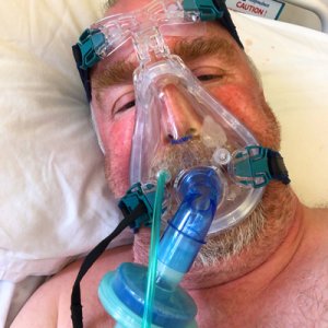 CPAP.jpg