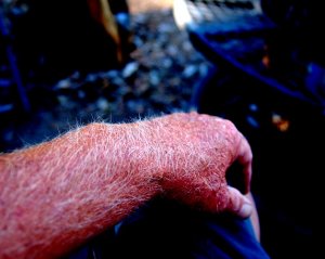 arm hair.jpg