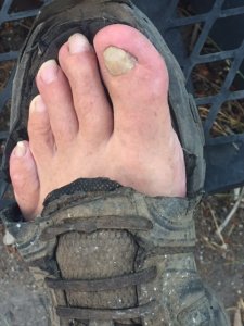 my big toe.jpg