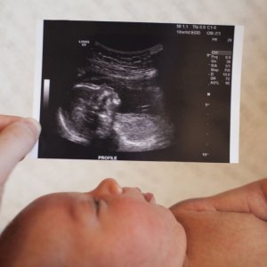 babyboyultrasound-7bf2ced4b4794754b67dea974b7ec744.jpg